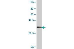 Western Blotting (WB) image for anti-Regulator of Chromosome Condensation (RCC1) and BTB (POZ) Domain Containing Protein 2 (RCBTB2) (AA 86-194) antibody (ABIN560350)
