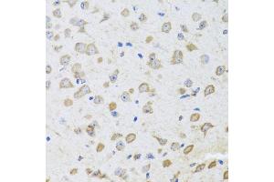 Immunohistochemistry of paraffin-embedded mouse brain using ARL6 antibody (ABIN5974886) at dilution of 1/100 (40x lens). (ARL6 抗体)