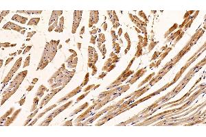 Detection of C1QBP in Mouse Cardiac Muscle Tissue using Polyclonal Antibody to Complement component 1 Q subcomponent-binding protein, mitochondrial (C1QBP)