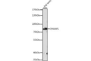 Western blot analysis of extracts of rat testis, using DN antibody (ABIN7268219) at 1:1000 dilution. (LRRC50 抗体  (AA 516-725))