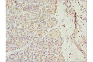 Immunohistochemistry of paraffin-embedded human pancreatic tissue using ABIN7167363 at dilution of 1:100 (Rab5c 抗体  (AA 1-216))
