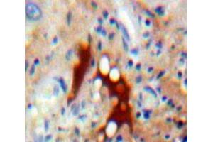 IHC-P analysis of Liver tissue, with DAB staining. (ASK1 抗体  (AA 693-933))