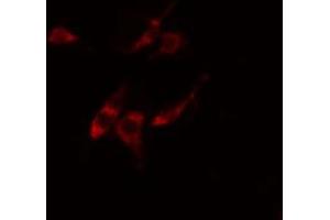 ABIN6274861 staining Hela cells by IF/ICC. (ARFIP1 抗体  (Internal Region))