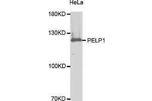 Western Blotting (WB) image for anti-Proline-, Glutamic Acid- and Leucine-Rich Protein 1 (PELP1) (AA 1021-1180) antibody (ABIN3023502) (PELP1 抗体  (AA 1021-1180))