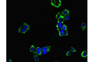 Immunofluorescent analysis of PC-3 cells using ABIN7155221 at dilution of 1:100 and Alexa Fluor 488-congugated AffiniPure Goat Anti-Rabbit IgG(H+L) (HPCAL1 抗体  (AA 2-193))
