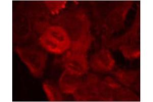 Image no. 1 for anti-Mitogen-Activated Protein Kinase Kinase 2 (MAP2K2) (pThr394) antibody (ABIN196623) (MEK2 抗体  (pThr394))
