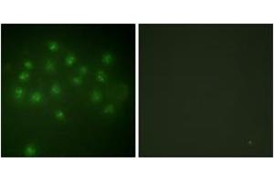 Immunofluorescence analysis of A549 cells, using Vitamin D Receptor (Phospho-Ser208) Antibody. (Vitamin D Receptor 抗体  (pSer208))
