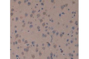 Used in DAB staining on fromalin fixed paraffin- embedded brain tissue (TOP1MT 抗体  (AA 11-238))