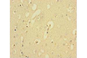 Immunohistochemistry (IHC) image for anti-Potassium Large Conductance Calcium-Activated Channel, Subfamily M, alpha Member 1 (KCNMA1) (AA 1-86) antibody (ABIN7146334)