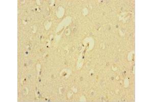 Immunohistochemistry of paraffin-embedded human brain tissue using ABIN7146334 at dilution of 1:100 (KCNMA1 抗体  (AA 1-86))
