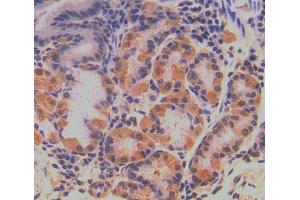 Used in DAB staining on fromalin fixed paraffin- embedded stomach tissue (QARS 抗体  (AA 514-775))