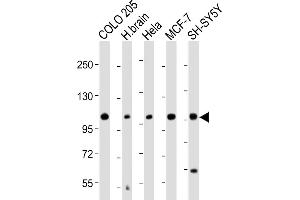 All lanes : Anti-KCNH1 Antibody (C-Term) at 1:2000 dilution Lane 1: COLO 205 whole cell lysate Lane 2: Human brain lysate Lane 3: Hela whole cell lysate Lane 4: MCF-7 whole cell lysate Lane 5: SH-SY5Y whole cell lysate Lysates/proteins at 20 μg per lane. (KCNH1 抗体  (AA 787-820))