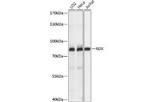 Western blot analysis of extracts of various cell lines using RDX Polyclonal Antibody at dilution of 1:1000. (Radixin 抗体)