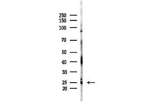 Western blot analysis of lysates from COLO205 cells(heat-shock,45 min treatment), using ATP5H Antibody at 1/1000 dilution.