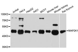 Western blot analysis of extracts of various cell lines, using MAP2K1 antibody. (MEK1 抗体  (AA 1-100))
