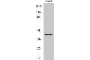 Western Blotting (WB) image for anti-Actin, beta-Like 2 (ACTBL2) (Internal Region) antibody (ABIN3173670) (ACTBL2 抗体  (Internal Region))