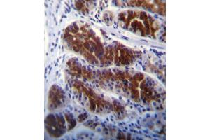 Immunohistochemistry (IHC) image for anti-Fyn-Related Kinase (FRK) antibody (ABIN3003444) (FRK 抗体)