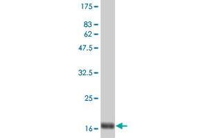 Western Blot detection against Immunogen (19. (IFNA2 抗体  (AA 24-188))