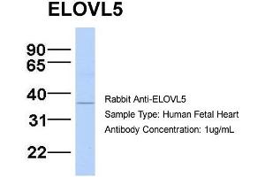 Host:  Rabbit  Target Name:  ELOVL5  Sample Type:  Human Fetal Heart  Antibody Dilution:  1. (ELOVL5 抗体  (N-Term))