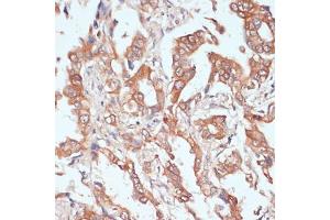 Immunohistochemistry (IHC) image for anti-Protein tyrosine Phosphatase, Receptor Type, N Polypeptide 2 (PTPRN2) (AA 22-242) antibody (ABIN7269710)