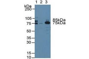 Western blot analysis of (1) Rat Blood Cells, (2) Human Platelet Cells and (3) Rat Serum. (Prothrombin 抗体  (AA 324-617))