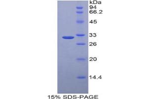 SDS-PAGE analysis of Human LRP5L Protein. (LRP5L 蛋白)