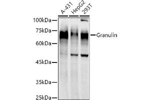Western blot analysis of extracts of various cell lines, using Granulin antibody  at 1:1000 dilution. (Granulin 抗体)