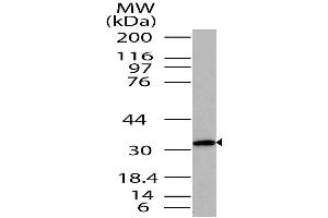 Image no. 1 for anti-ST2V Or ST2 (AA 150-300) antibody (ABIN5027547) (ST2V Or ST2 (AA 150-300) 抗体)