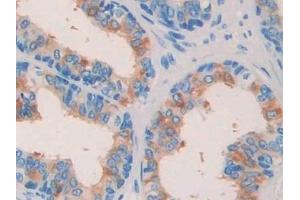 Detection of NGF in Human Prostate Tissue using Polyclonal Antibody to Nerve Growth Factor (NGF) (Nerve Growth Factor 抗体  (AA 19-239))
