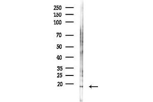 anti-Defensin, beta 132 (DEFB132) antibody