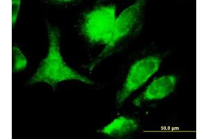 Immunofluorescence of monoclonal antibody to TNFSF6 on HeLa cell. (FASL 抗体  (AA 1-281))