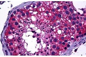 Human Testis: Formalin-Fixed, Paraffin-Embedded (FFPE) (DIAPH2 抗体  (AA 56-114))
