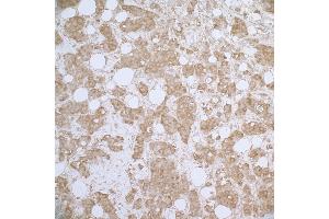 Immunohistochemistry (IHC) image for anti-Heat Shock 27kDa Protein 1 (HSPB1) (AA 150-200) antibody (ABIN7453910) (HSP27 抗体  (AA 150-200))
