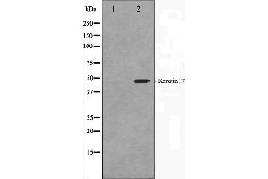Western blot analysis on HuvEc cell lysate using Keratin 17 Antibody.