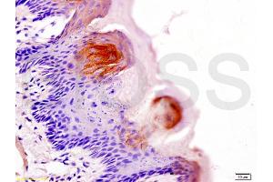Formalin-fixed and paraffin embedded rat tongue labeled with Anti-AQP-3 Polyclonal Antibody, Unconjugated (ABIN673974) at 1:200 followed by conjugation to the secondary antibody and DAB staining (AQP3 抗体  (AA 201-292))