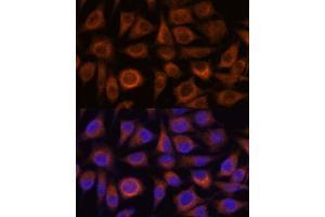 Immunofluorescence analysis of L929 cells using TRIM16 antibody (ABIN7270978) at dilution of 1:100. (TRIM16 抗体  (AA 1-210))