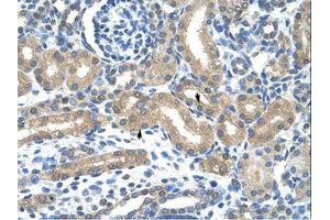 Image no. 1 for anti-Hypoxia Inducible Factor 3, alpha Subunit (HIF3A) (C-Term) antibody (ABIN203237) (HIF3A 抗体  (C-Term))