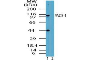 PACS1 antibody  (AA 300-350)