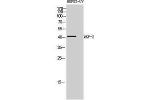 Western Blotting (WB) image for anti-Dual Specificity Phosphatase 4 (DUSP4) (Internal Region) antibody (ABIN3176026) (DUSP4 抗体  (Internal Region))