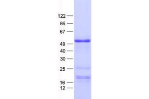 Western Blotting (WB) image for SRY (Sex Determining Region Y)-Box 7 (SOX7) protein (His tag) (ABIN2732470)