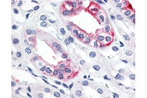 Anti-ESRRG / ERR Gamma antibody IHC of human kidney. (ESRRG 抗体  (C-Term))