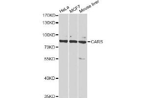 Western blot analysis of extracts of various cell lines, using CARS antibody (ABIN2561571) at 1:1000 dilution. (CARS 抗体)