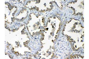 Immunohistochemistry (IHC) image for anti-Dynein, Light Chain, Tctex-Type 1 (DYNLT1) (AA 1-80) antibody (ABIN5693148)