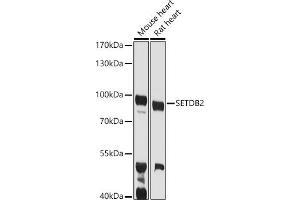 Western blot analysis of extracts of various cell lines, using SETDB2 antibody (ABIN6131576, ABIN6147657, ABIN6147658 and ABIN6223256) at 1:1000 dilution. (SETDB2 抗体  (AA 1-280))