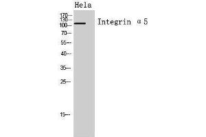 Western Blotting (WB) image for anti-Integrin, alpha 5 (ITGA5) (Internal Region) antibody (ABIN3188019) (ITGA5 抗体  (Internal Region))
