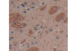 Immunohistochemistry (IHC) image for anti-Orosomucoid 1 (ORM1) (AA 20-186) antibody (ABIN1077770)