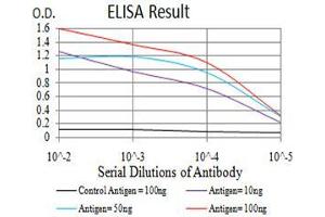 Black line: Control Antigen (100 ng), Purple line: Antigen(10 ng), Blue line: Antigen (50 ng), Red line: Antigen (100 ng), (SIRT7 抗体  (AA 1-105))