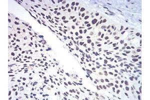 Immunohistochemistry (IHC) image for anti-RAD50 Homolog (S. Cerevisiae) (RAD50) (AA 228-359) antibody (ABIN5542671)