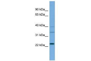 WB Suggested Anti-RALA Antibody Titration: 0. (rala 抗体  (Middle Region))