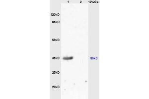 Lane 1:mouse kidney lysates Lane 2: mouse brain lysates probed with Anti-MC-1R/MC1 Receptor Polyclonal Antibody, Unconjugated (ABIN686287) at 1:200 in 4 °C. (MC1 Receptor 抗体  (AA 271-317))
